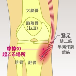 鵞足炎とは