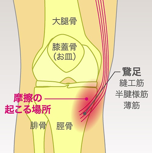 曲げる と 膝 が 痛い