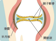 膝にたまる水は関節滑液