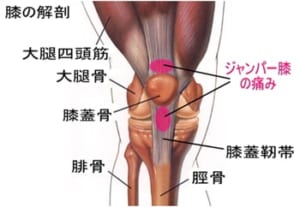 ジャンパー膝 説明