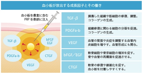 PRP療法で分泌される成長因子