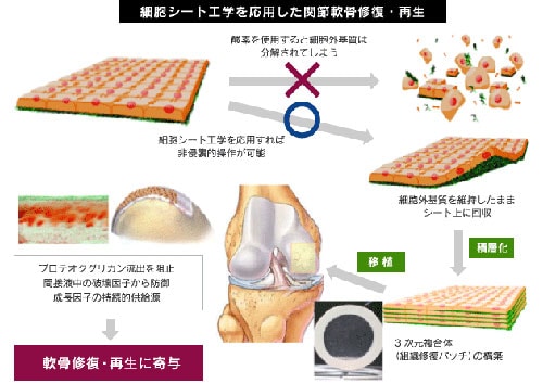 軟骨細胞シートと再生医療