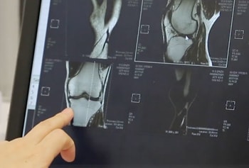 変形性膝関節症の名医は説明上手