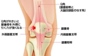 膝の脱臼とQ角