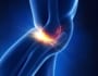 【変形性膝関節症の最新治療】患者が語る再生医療の効果とは？