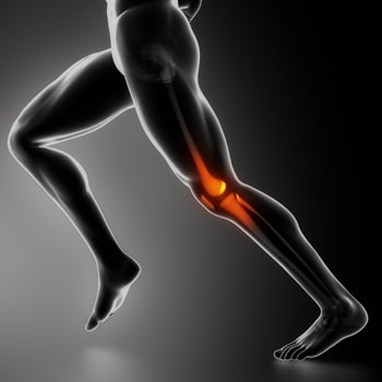 膝の外側の痛みで考えられる疾患と、自分でできる対処法