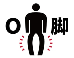 変形性膝関節症とO脚の負の連鎖を断ち切る!これが専門家の矯正法