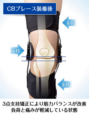 CBブレース