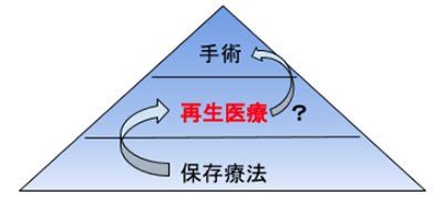 変形性膝関節症の再生医療が手術を遅らせる