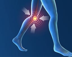 サインは膝の内側の痛み。早めの治療が肝心な「変形性膝関節症」とは